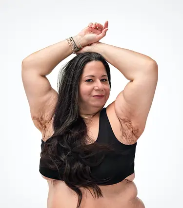 To the left of the image, a woman with brown hair poses looking into the camera while raising her arms showing scars from her hidradenitis suppurativa (HS) flares in her armpits. To her right reads a headline: "HS TRUTHS: It's not your hygiene. It's not caused by your weight. It's not your fault" Below is a tag with the patient's name which reads "Tatiana, real HS patient."