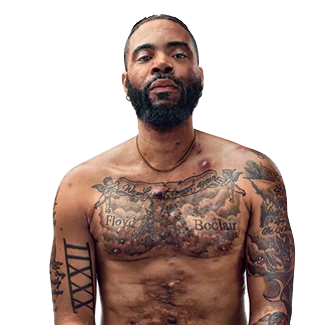 A Black man with a beard, and hidradenitis suppurativa (HS), poses facing the camera with his tattooed chest exposed, with his arm up to show scars from his HS flares. Below the photo is a tag with the patient's name which reads "Jawan, real HS patient." 
