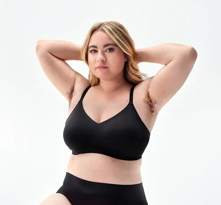 A white woman with blonde hair poses with an empowered expression on her face in a bra and underwear with her arms raised showing her HS scars under her armpits.