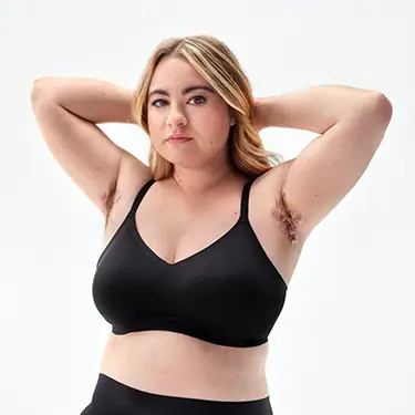 A white woman with blonde hair poses with an empowered expression on her face in a bra and underwear with her arms raised showing her HS scars under her armpits.