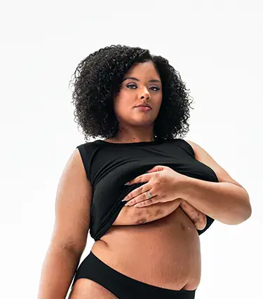 To the left of the image, a Black woman poses looking into the camera while lifting up her shirt, showing scars from her hidradenitis suppurativa (HS) flares under her right and left breasts. To her right reads a headline: "HS TRUTH: Your voice matters, and your care depends on it" Below the headline is a tag with the patient's name which reads "Jasmine S, real HS patient."
