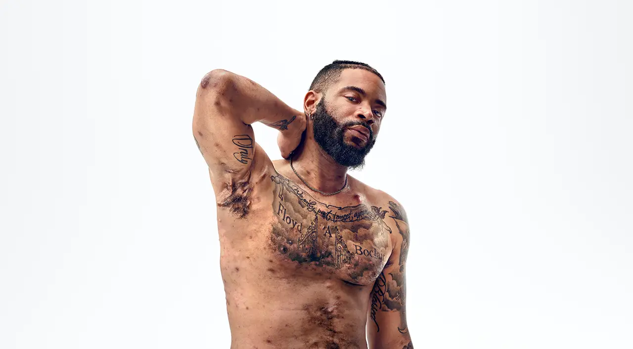 A Black man with a beard, and hidradenitis suppurativa (HS), poses facing the camera with his tattooed chest exposed, with his arm up to show scars from his HS flares. Below the photo is a tag with the patient's name which reads "Jawan, real HS patient." 