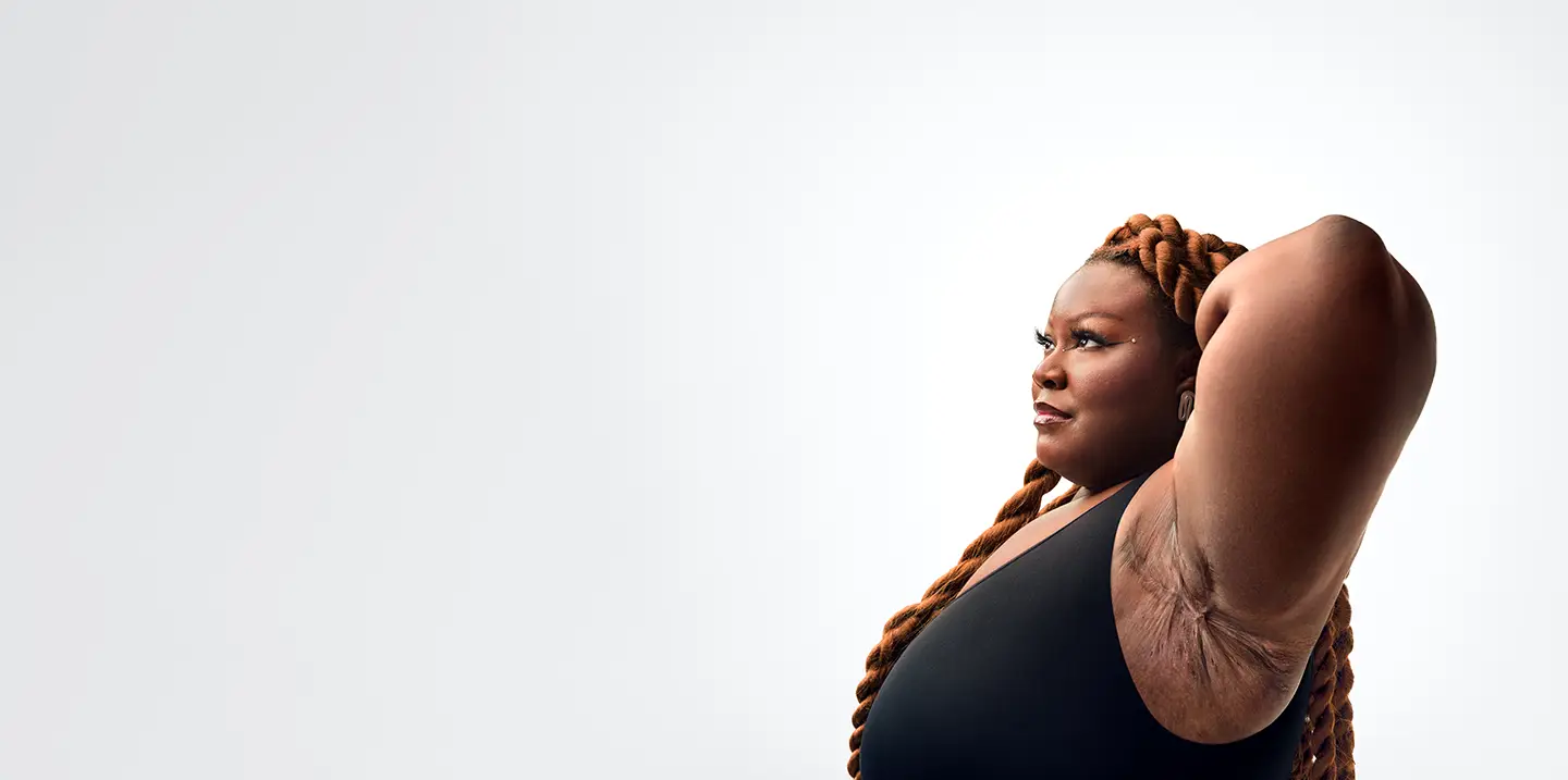 To the right of the image, a Black woman poses with long braids and a powerful expression with her face and her left arm up showing scars from her hidradenitis suppurativa (HS) flares. To her right reads a headline: "HS TRUTH: You don't have to manage alone. Stay connected." Below the headline is a tag with the patient's name which reads "Jasmine E, real HS patient."  