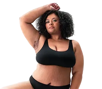 A Black woman poses looking into the camera while lifting up her arm, showing scars from her hidradenitis suppurativa (HS) flares under her armpit. Below her image is a tag with the patient's name which reads "Jasmine S, real HS patient."