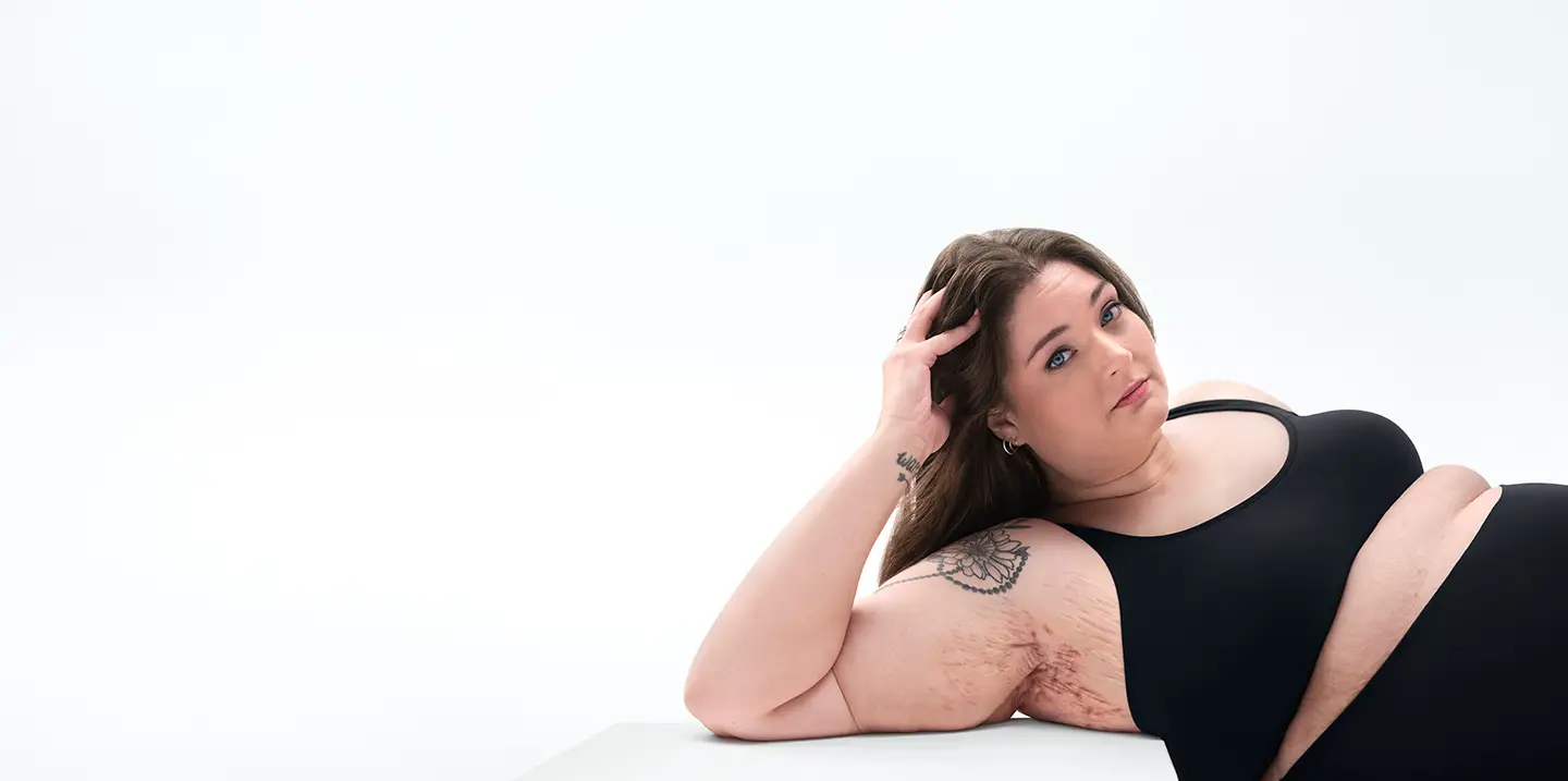 To the right of the image a White woman who has brown hair poses looking into the camera leaning on her arm and showing her armpit with HS scars from her hidradenitis suppurativa (HS) flares. To the left of the image a tag reads "Helpful Resources". Below the image is a tag with the patient's name which reads "Katelyn, real HS patient."  