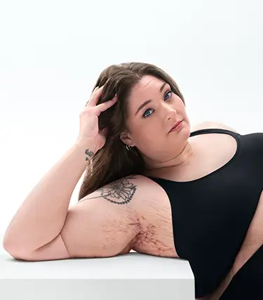 To the right of the image a White woman who has brown hair poses looking into the camera leaning on her arm and showing her armpit with HS scars from her hidradenitis suppurativa (HS) flares. To the left of the image a tag reads "Helpful Resources". Below the image is a tag with the patient's name which reads "Katelyn, real HS patient."  